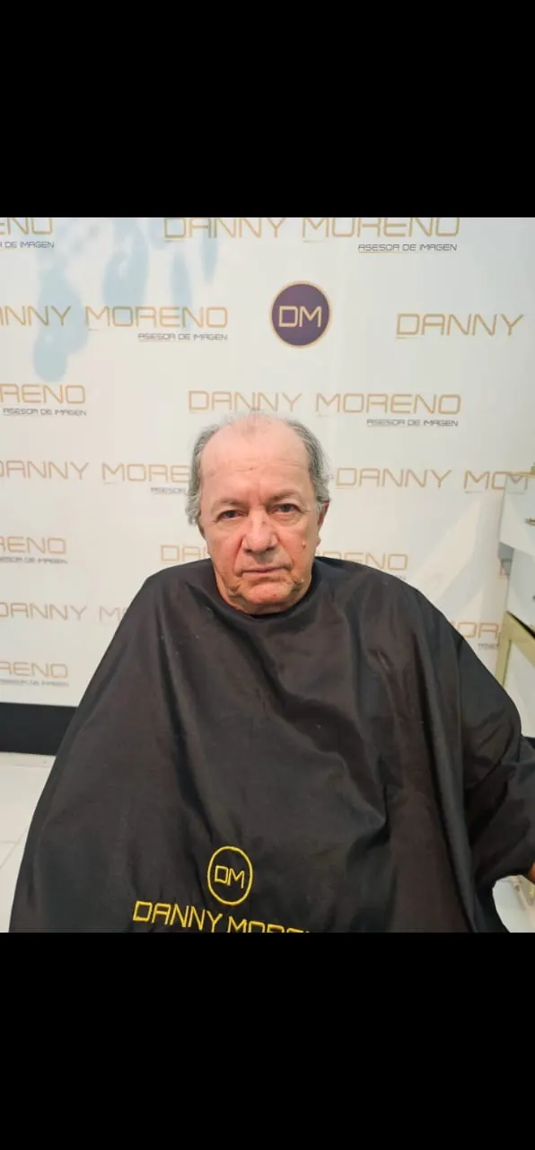Antes: pérdida de densidad con canas